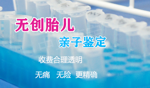 遂宁怀孕如何做亲子鉴定最简单方便,遂宁孕期亲子鉴定要多少钱的费用 遂宁怀孕如何做亲子鉴定最简单方便,遂宁孕期亲子鉴定要多少钱的费用